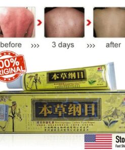 Geavanceerde natuurlijke kruidencrème voor psoriasis en eczeem