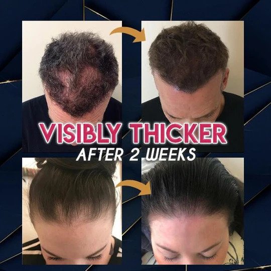 Pure Grow Haargroei Essentie