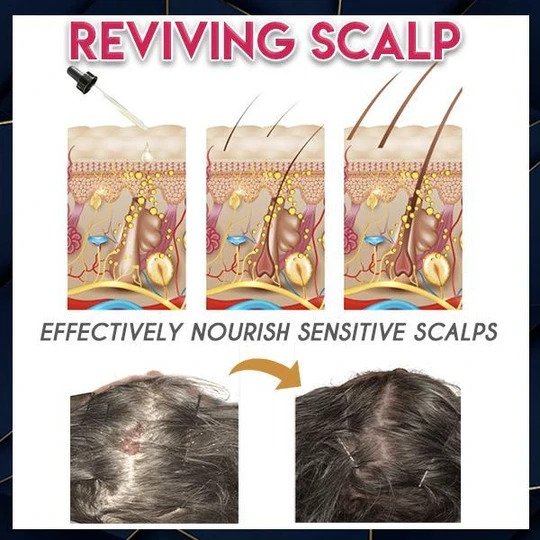 Pure Grow Haargroei Essentie - Image 2