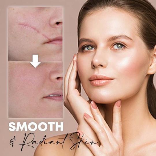 Medease Huidrebound Crème - Image 3