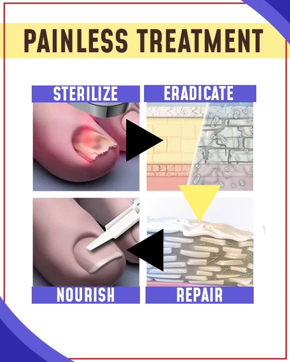 Anti-schimmelbehandelingssets voor blauw licht - Image 2