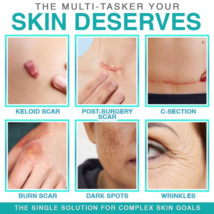 ๐๐ฎ๐ฟ๐ฒ๐๐ฟ๐ฒ๐ฒ๐๐ฒยฎ 3-in-1 micronaaldverzorgingspatch - Image 2