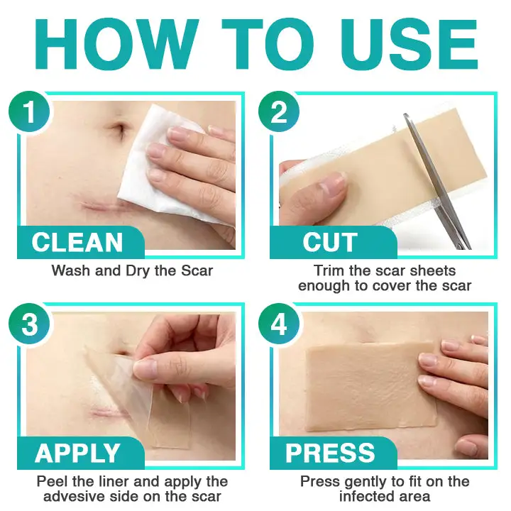 ๐๐ฎ๐ฟ๐ฒ๐๐ฟ๐ฒ๐ฒ๐๐ฒยฎ 3-in-1 micronaaldverzorgingspatch - Image 7