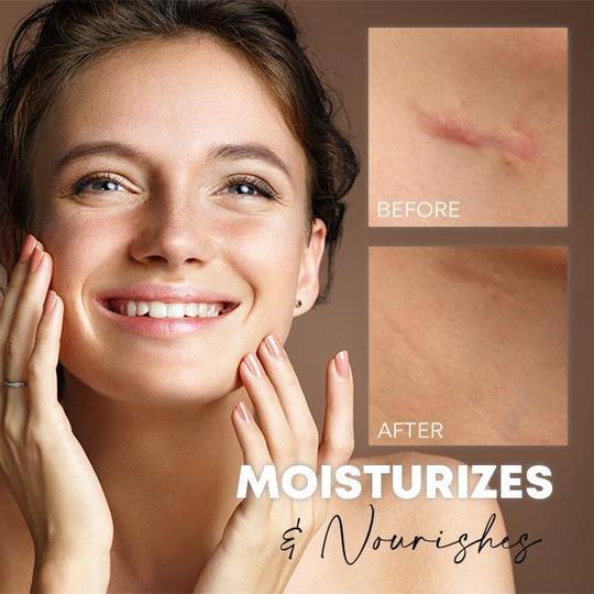 Medease Huidrebound Crème - Image 4