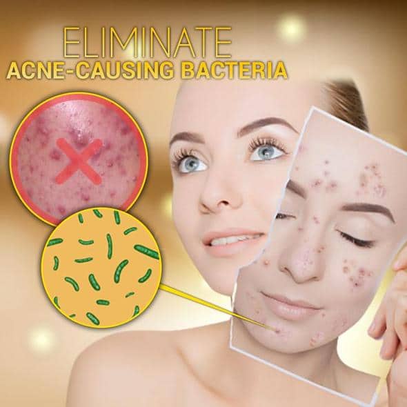 SkinClear verhelderende maskne-spray - Image 3