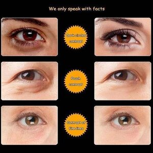 Slangengif Oogcrème - Image 5