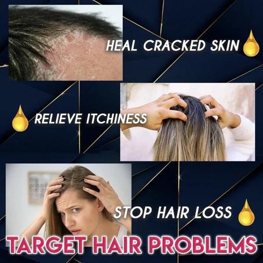 Pure Grow Haargroei Essentie - Image 6