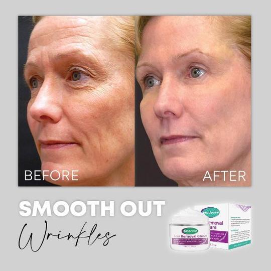 Medease Huidrebound Crème - Image 7