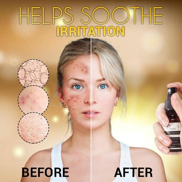 SkinClear verhelderende maskne-spray - Image 7