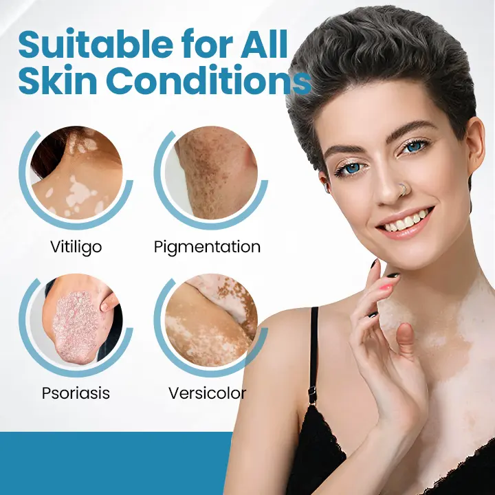 Acezozla® DermaBeam Vitiligo-therapieapparaat - Image 2