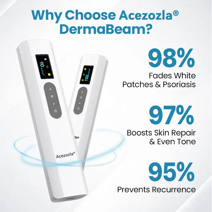 Acezozla® DermaBeam Vitiligo-therapieapparaat - Image 6