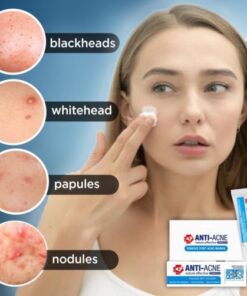 AcneClear vlekverwijderingscrème