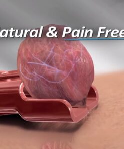 Koperen tag-out huidtagverwijderaar