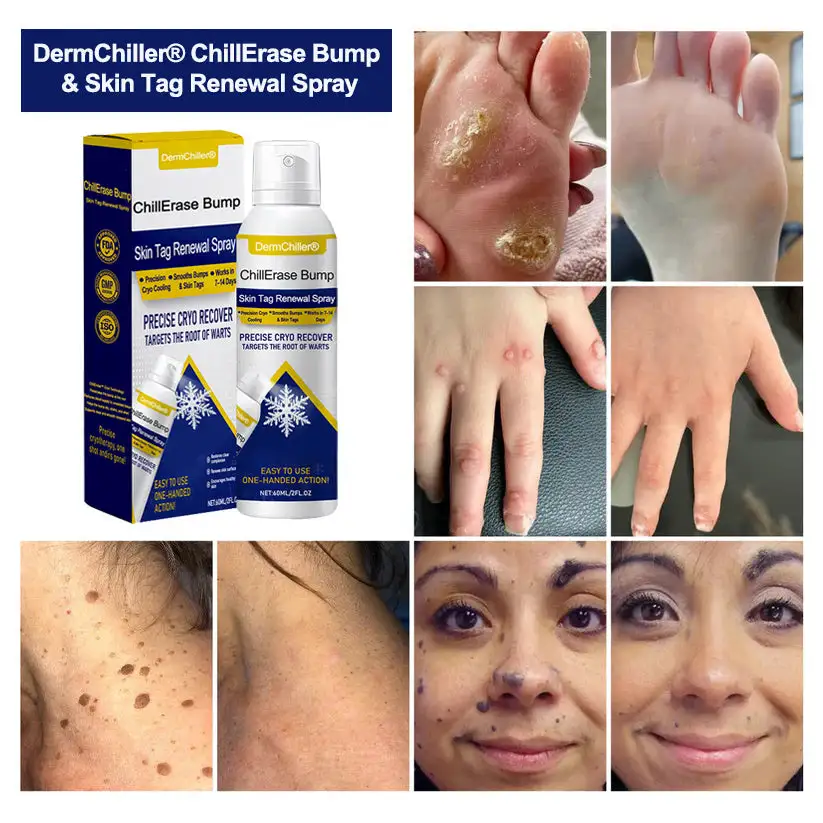 DermChiller® ChillErase Bump & Skin Tag Vernieuwingsspray - Image 2
