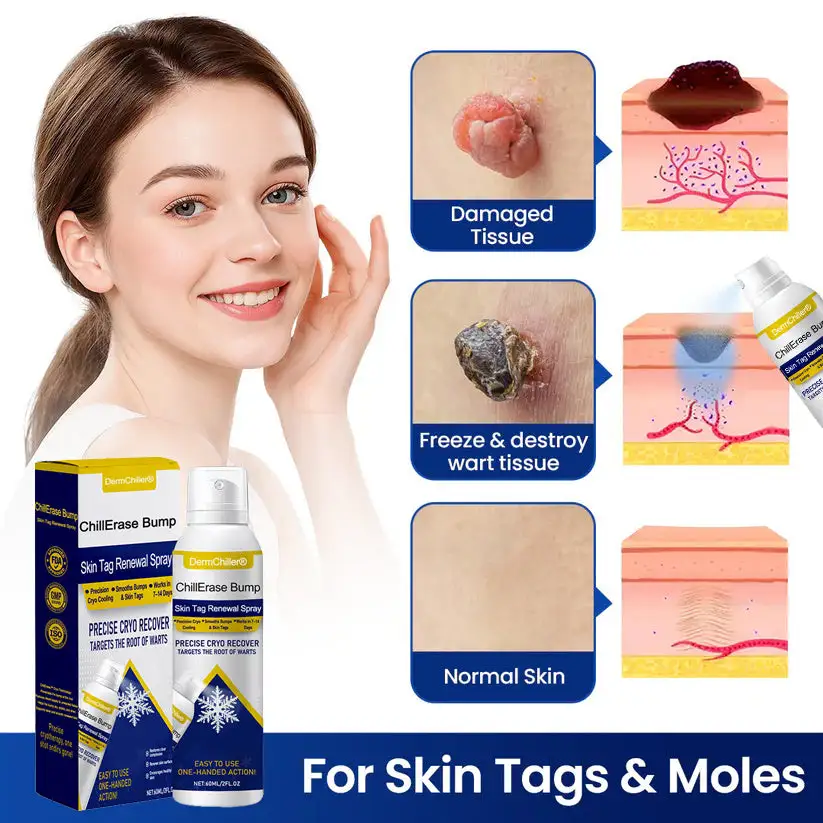 DermChiller® ChillErase Bump & Skin Tag Vernieuwingsspray - Image 7