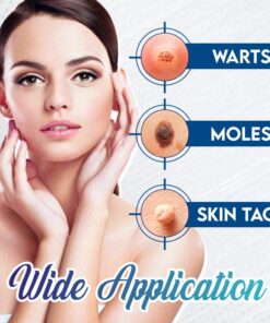 Gel voor onmiddellijke vlekverwijdering