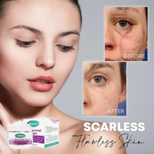 Medease Huidrebound Crème