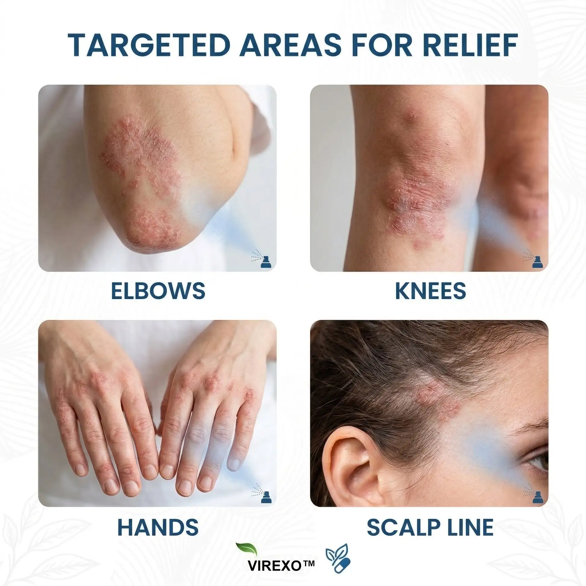 Virexo™ Magnesium Botanische Spray - Image 2