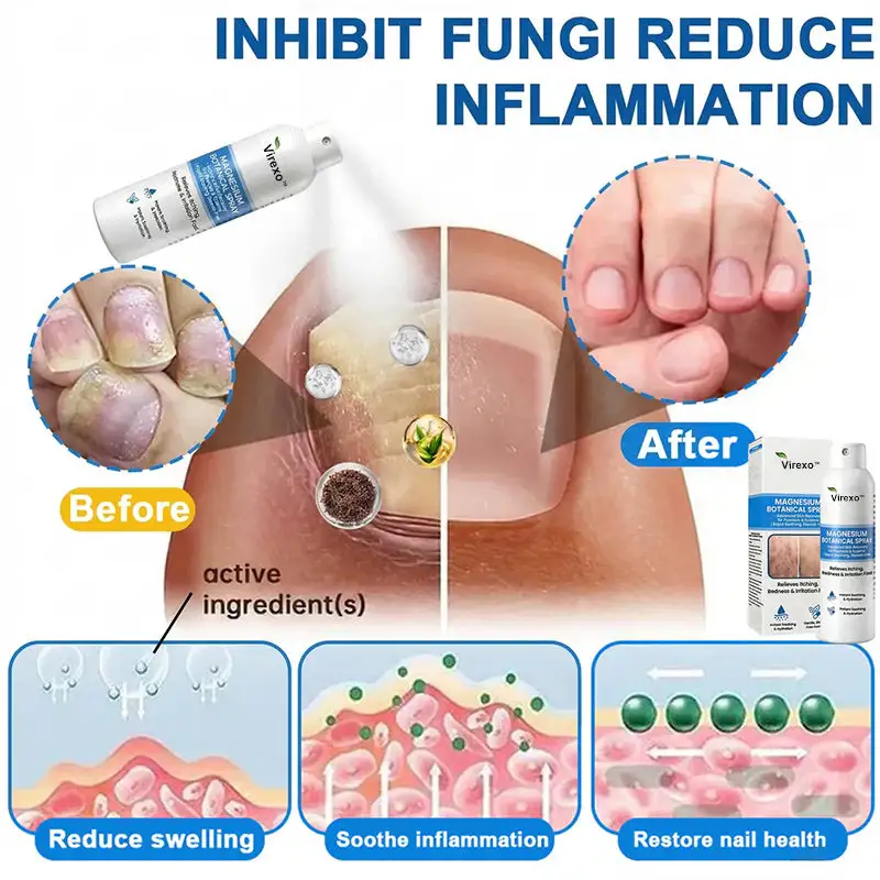 Virexo™ Magnesium Botanische Spray - Image 4