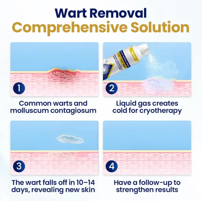 Yagoo® Chillique Bump Vernieuwingsspray - Image 3