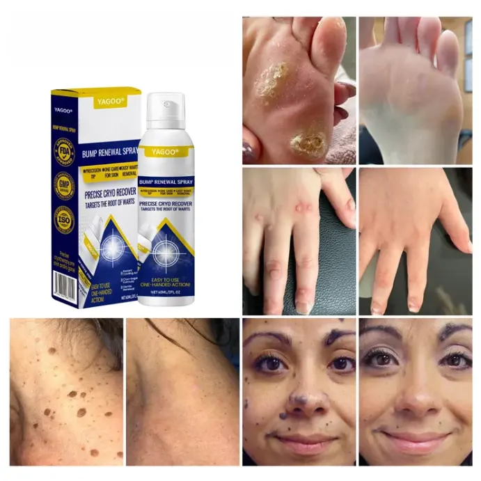 Yagoo® Chillique Bump Vernieuwingsspray - Image 5